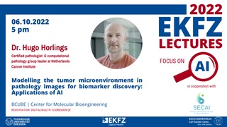 EKFZ Lecture Focus on AI